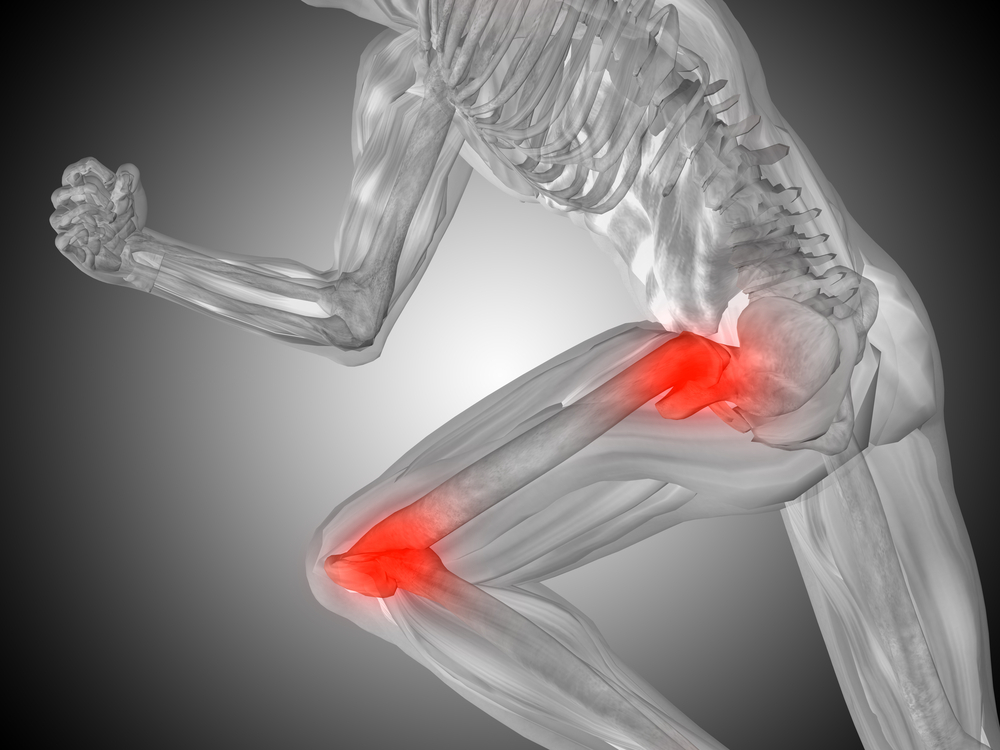 Joint Pain & Trigger Point Injections in West New York, NJ